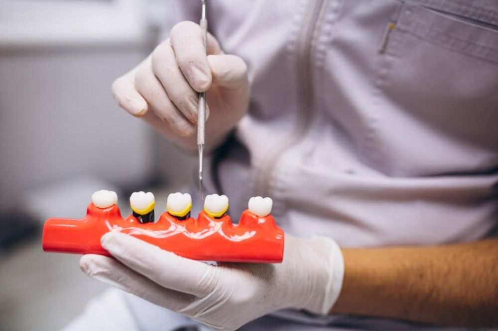 dentist showing dental bridges for demo